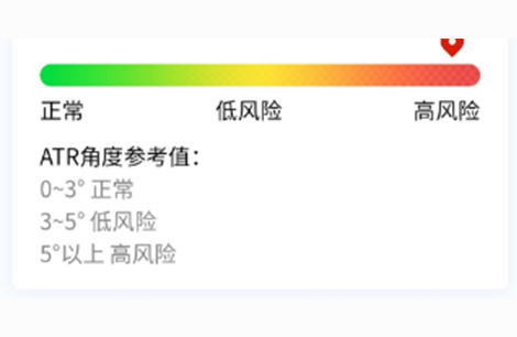 风险解析